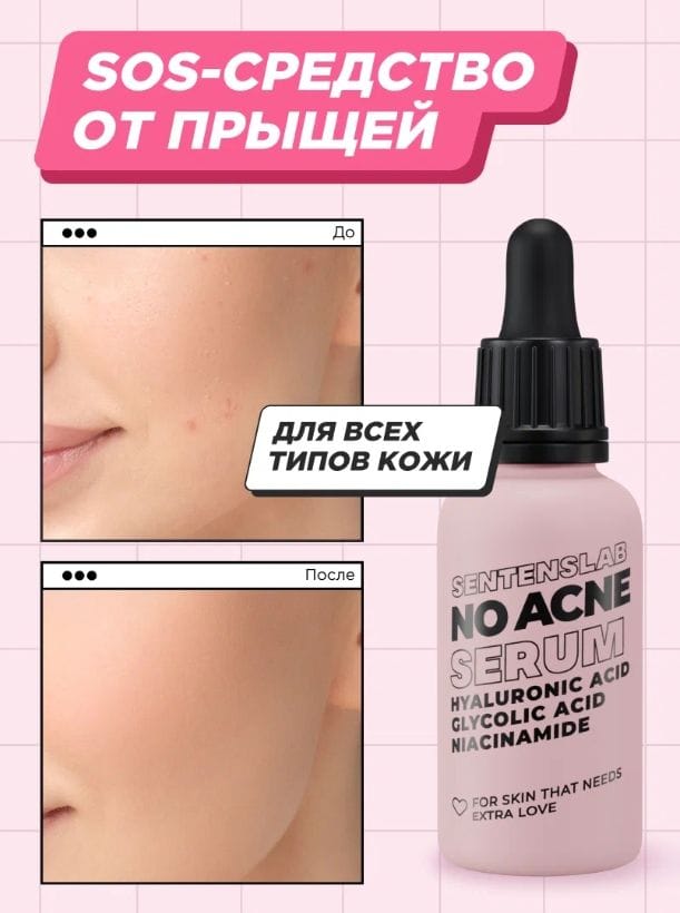 Сыворотка для лица SENTENSLAB с гликолевой кислотой ниацинамидом против прыщей акне угрей для проблемной кожи